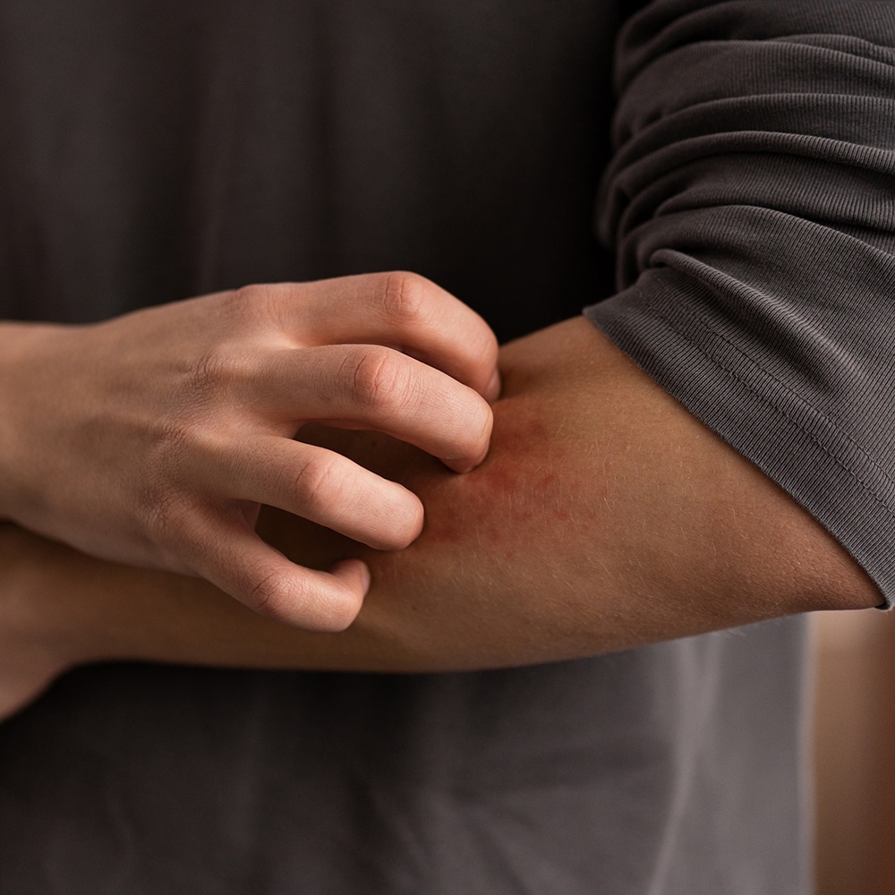 Cockroach Bites and Health Risks - Should You Be Worried? in Central Coast NSW